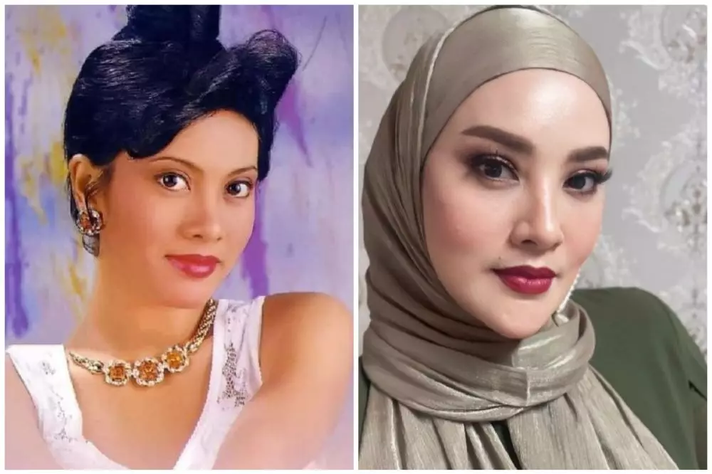 seleb 50an sebelum sesudah operasi plastik © berbagai sumber