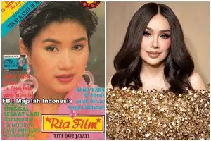 Bukti wajah awet muda itu butuh duit, 7 potret seleb usia 50-an sebelum dan sesudah operasi plastik