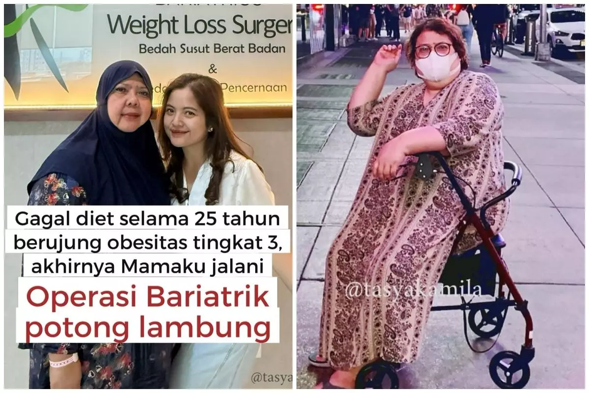 5 Perjalanan ibunda Tasya Kamila gagal diet 25 tahun berujung obesitas, putuskan operasi bariatrik