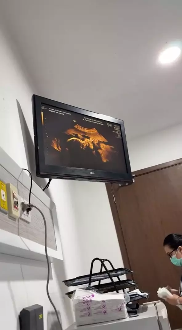 Steffi Zamora cek kandungan © TikTok Steffi Zamora cek kandungan © TikTok