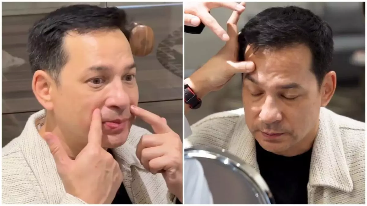 Emoh wajahnya keriput di usia lebih setengah abad, ini 9 potret Ari Wibowo oplas antiaging di Korea