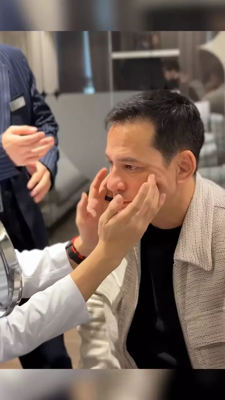 Ari Wibowo operasi antiaging di Korea Selatan © 2025 Instagram