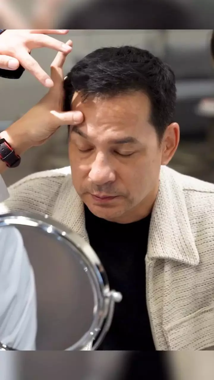 Ari Wibowo operasi antiaging di Korea Selatan © 2025 Instagram