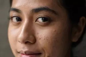 Tanpa disadari, 7 kandungan skincare ini diam-diam perparah pori-pori wajah