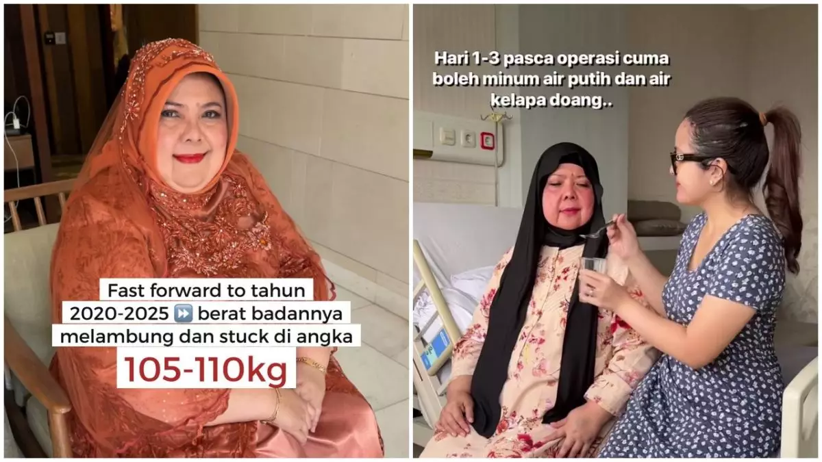 9 Potret transformasi ibu Tasya Kamila setelah operasi bariatrik, berhasil turun 7 kg dalam seminggu