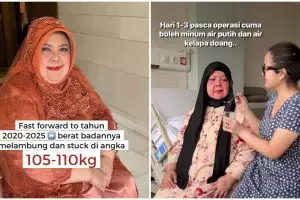 9 Potret transformasi ibu Tasya Kamila setelah operasi bariatrik, berhasil turun 7 kg dalam seminggu