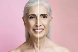 Nggak perlu pakai krim antiaging, ini trik pudarkan kerutan dan garis halus dari 2 jenis bahan pemanis