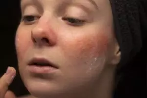 9 Krim malam untuk kulit sensitif, wajah bebas iritasi harga di bawah Rp 150 ribu