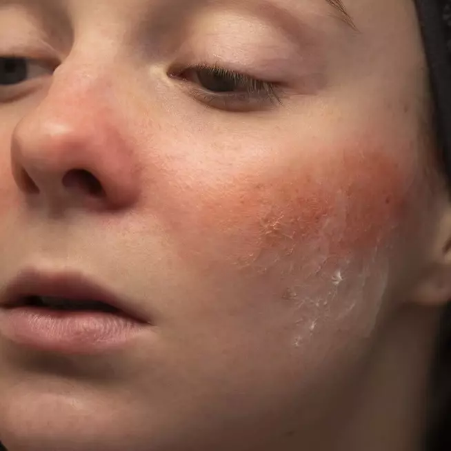 9 Krim malam untuk kulit sensitif, wajah bebas iritasi harga di bawah Rp 150 ribu