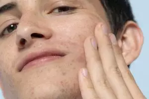 10 Krim malam menghilangkan flek hitam, wajah makin bersinar dan mulus harga di bawah Rp 150 ribu