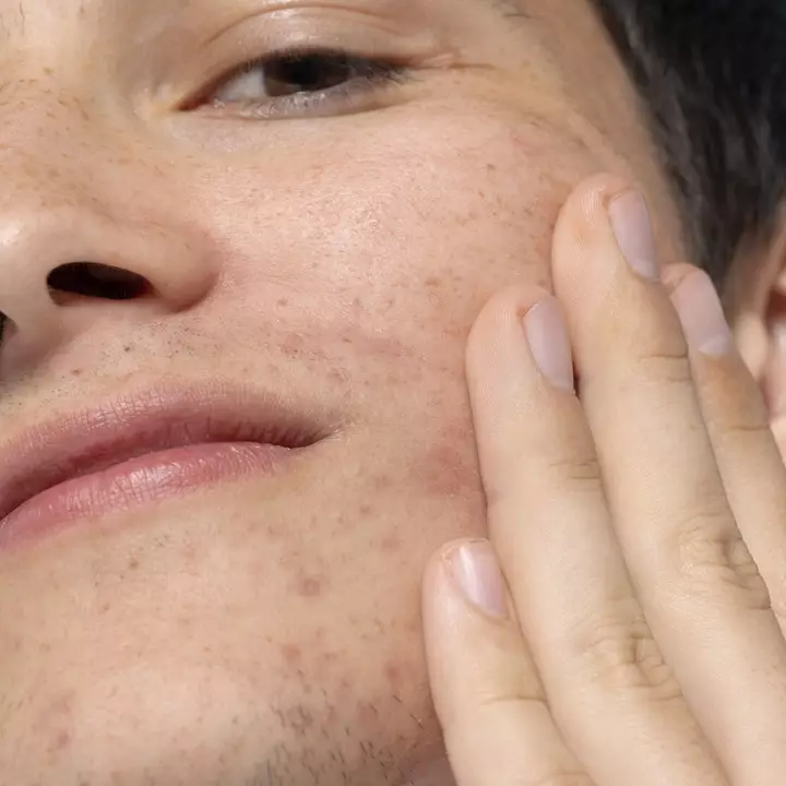 10 Krim malam menghilangkan flek hitam, wajah makin bersinar dan mulus harga di bawah Rp 150 ribu