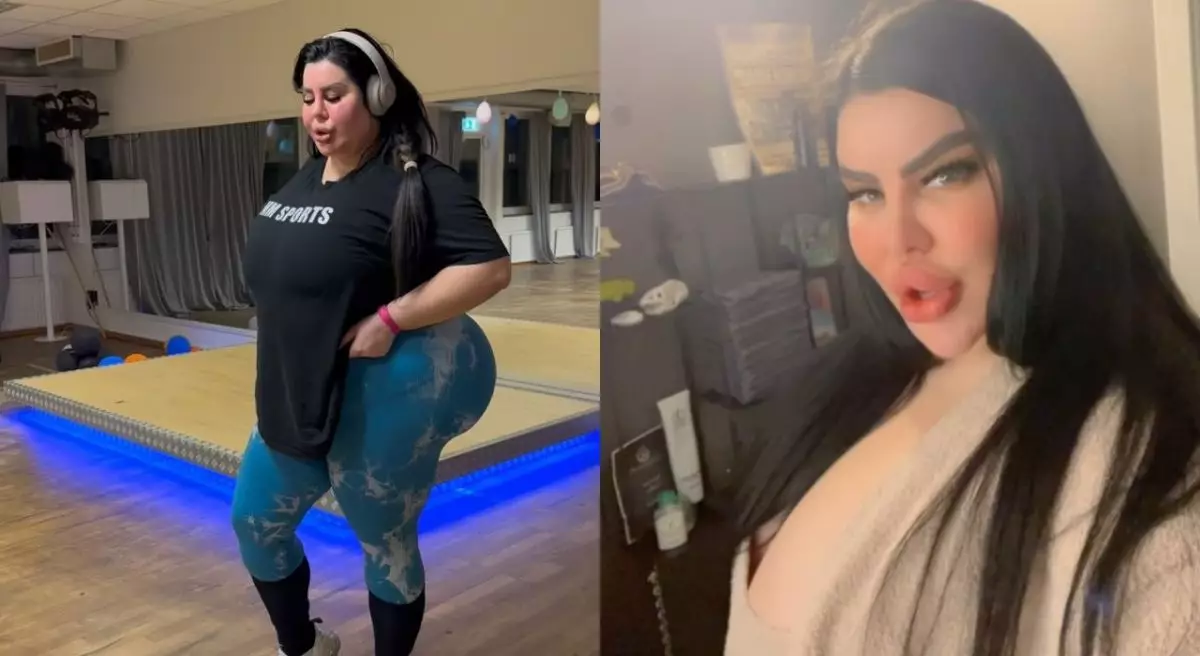 Demi punya bokong terbesar di dunia, model Serbia ini rela suntik 45 kg lemak dalam 9 tahun