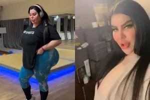 Demi punya bokong terbesar di dunia, model Serbia ini rela suntik 45 kg lemak dalam 9 tahun