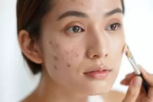 10 Rekomendasi BB cream terbaik untuk kulit berjerawat, ringan tapi coverage maksimal