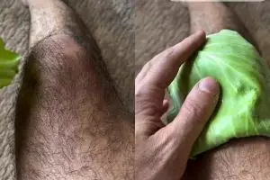 Pria ini coba tempelkan kubis di lutut untuk redakan nyeri, begini penjelasan ilmiahnya 