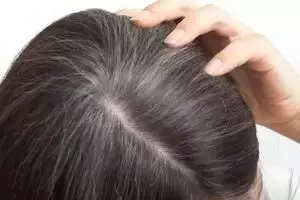 Uban bikin minder? ini trik menghitamkan rambut tanpa semir dan urang-aring, andalkan 1 jenis minuman
