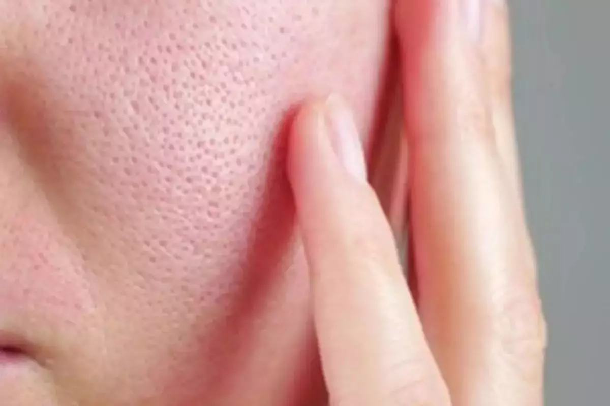 Tak banyak yang tahu, bunga ini ampuh kecilkan pori-pori wajah dan kulit nggak berminyak, ini caranya