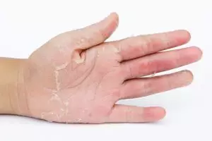 Tanpa dibalur dengan hand mask, ini trik kencangkan tangan keriput cuma andalkan 1 bahan pelembap