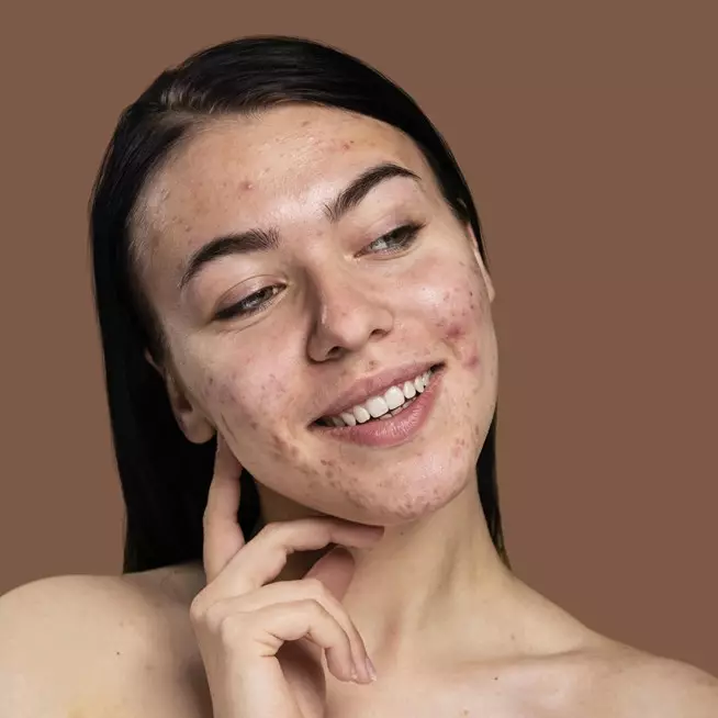 8 Skincare anti aging terbaik, jerawat sirna wajah kembali mulus harga di bawah Rp 150 ribu