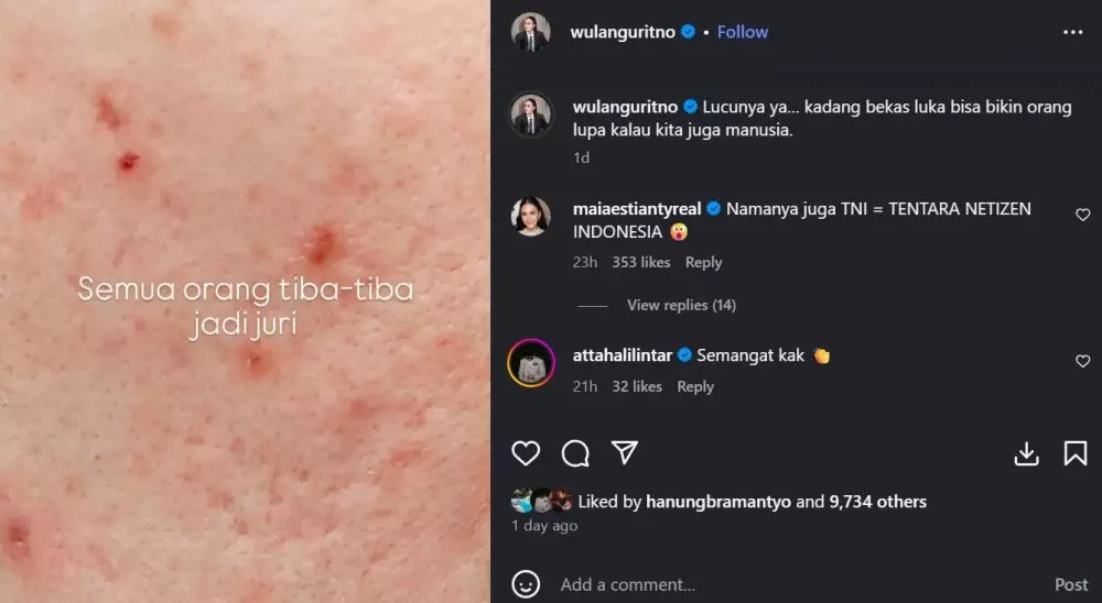 Viral wajah Wulan Guritno disebut tidak semulus © berbagai sumber Viral wajah Wulan Guritno disebut tidak semulus © berbagai sumber