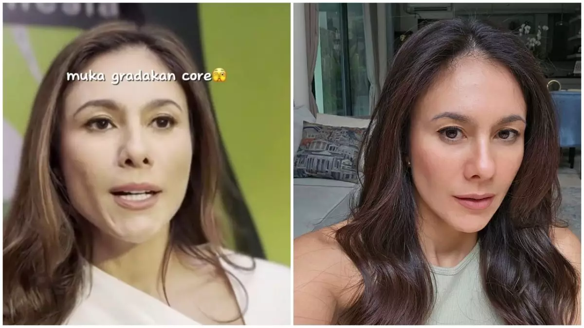 Pernah insecure karena wajah penuh bopeng, Wulan Guritno ungkap usahanya pulihkan kulit jadi mulus