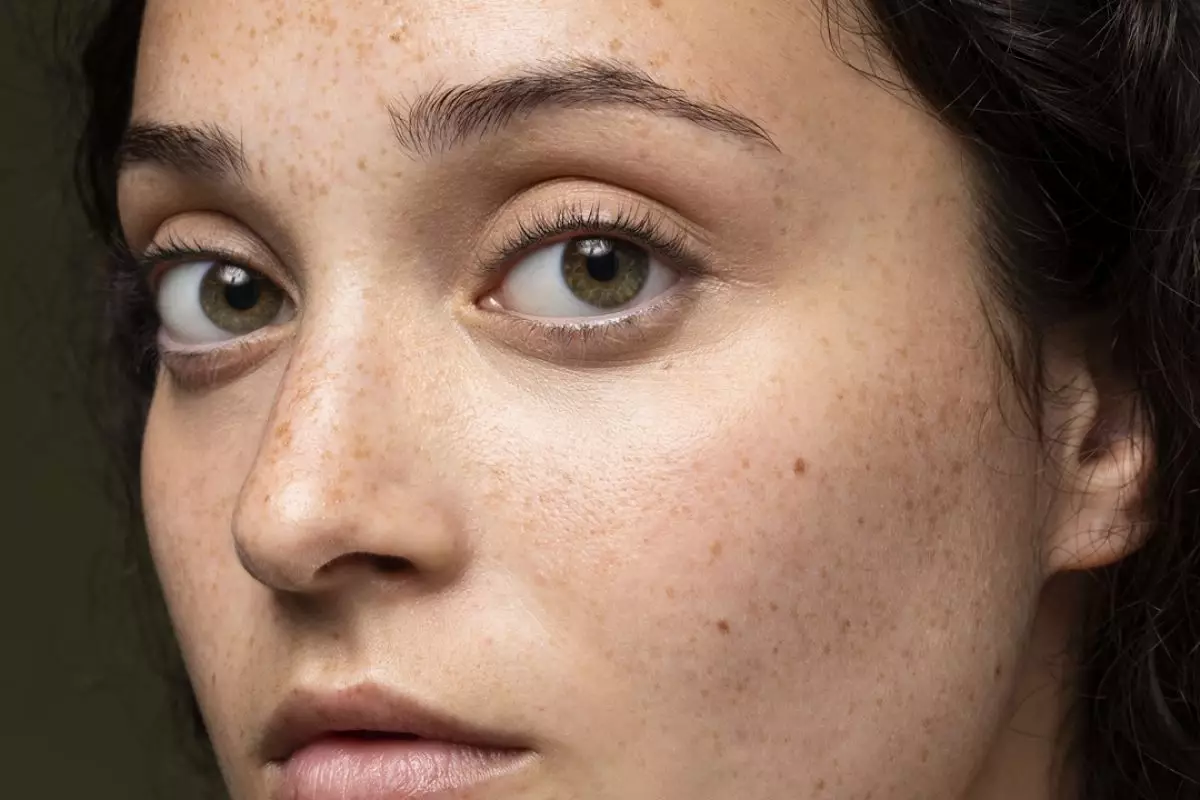 Nggak cuma air beras, ternyata kulit jeruk bisa hapus noda hitam dan bikin wajah glowing alami