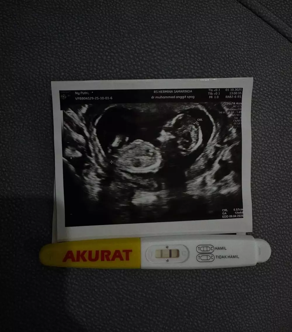 Putri Isnari bahagia umumkan kehamilan © Instagram