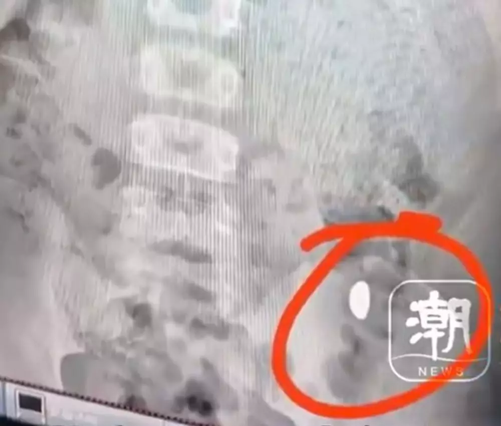 Bocah tak sengaja telan emas © 2025 brilio.net Bocah tak sengaja telan emas © 2025 brilio.net