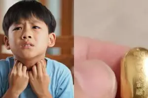 Gara-gara tak sengaja telan emas seharga Rp23 juta, bocah ini dilarang BAB sembarangan