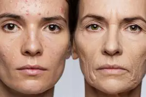 5 Skincare G2G Glad2Glow bantu mengecilkan pori-pori wajah, wajah cerah kencang di bawah Rp100 ribu