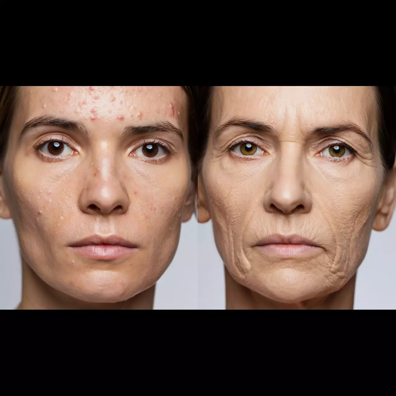 5 Skincare G2G Glad2Glow bantu mengecilkan pori-pori wajah, wajah cerah kencang di bawah Rp100 ribu