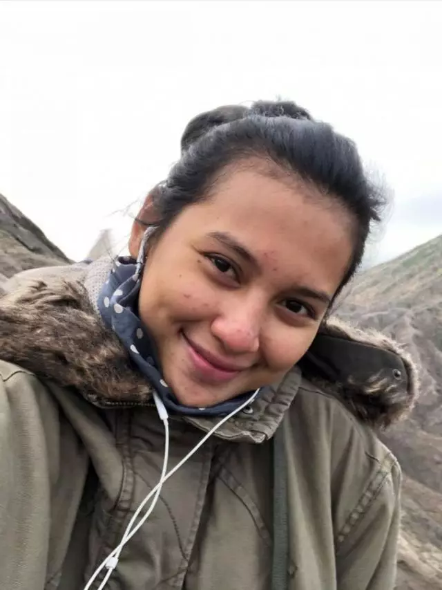 artis pamer wajah berjerawat © Instagram artis pamer wajah berjerawat © Instagram