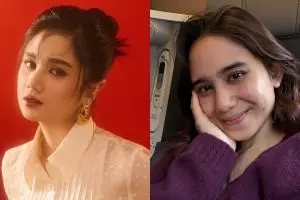 Bukti cantik nggak harus mulus, 11 potret seleb ini tampil percaya diri dengan wajah berjerawat