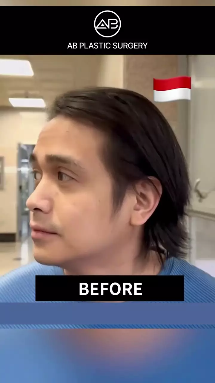 Penampilan Ajun Perwira usai operasi plastik © 2025 brilio.net