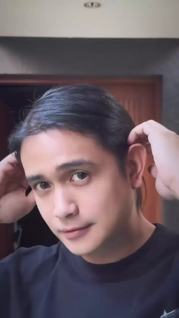 Penampilan Ajun Perwira usai operasi plastik © 2025 brilio.net