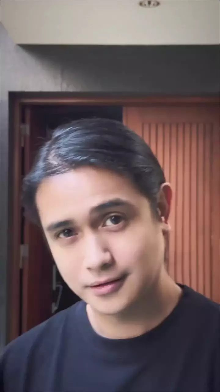 Penampilan Ajun Perwira usai operasi plastik © 2025 brilio.net