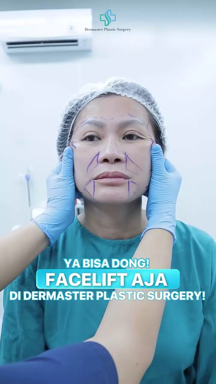 Ci Mehong facelift di usia 54 tahun © 2025 brilio.net Ci Mehong facelift di usia 54 tahun © 2025 brilio.net