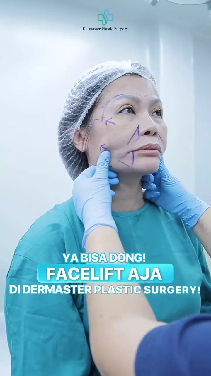 Ci Mehong facelift di usia 54 tahun © 2025 brilio.net Ci Mehong facelift di usia 54 tahun © 2025 brilio.net