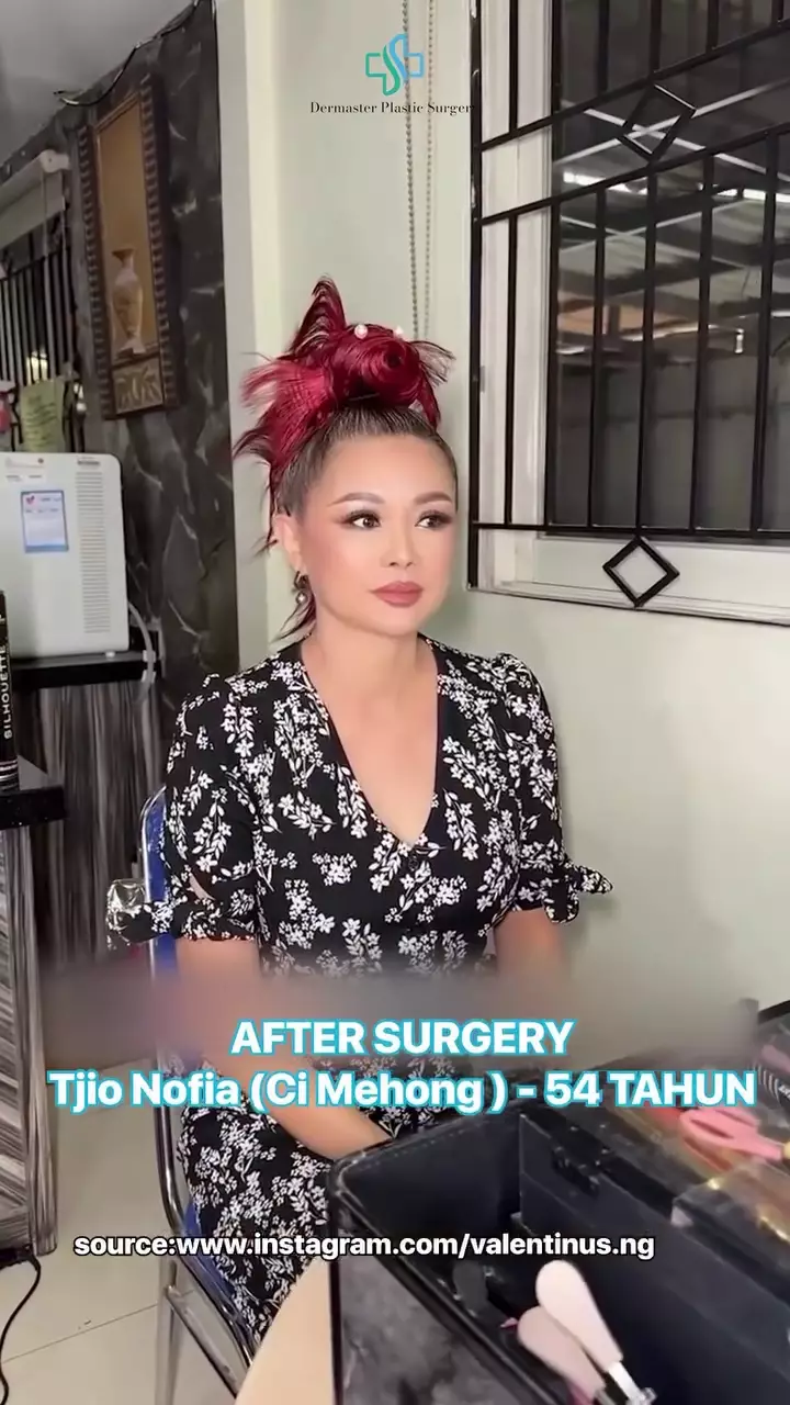 Ci Mehong facelift di usia 54 tahun © 2025 brilio.net Ci Mehong facelift di usia 54 tahun © 2025 brilio.net