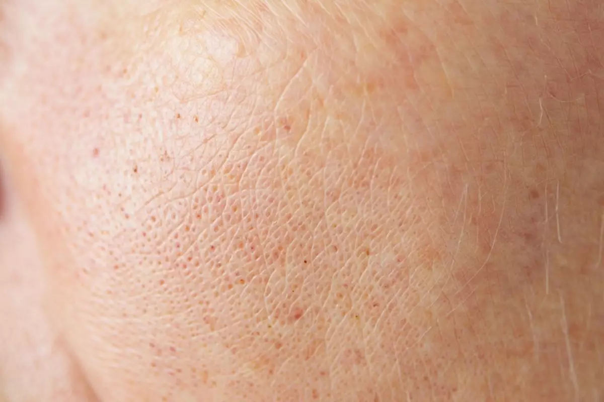 10 Krim malam mengandung kolagen, bantu kulit tetap mulus dan awet muda jauh dari kerutan dini