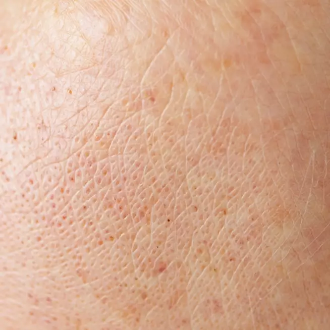 10 Krim malam mengandung kolagen, bantu kulit tetap mulus dan awet muda jauh dari kerutan dini