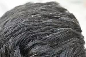 Trik mengubah uban jadi rambut hitam lebat lagi dengan 1 jenis daun, tak perlu pakai urang-aring