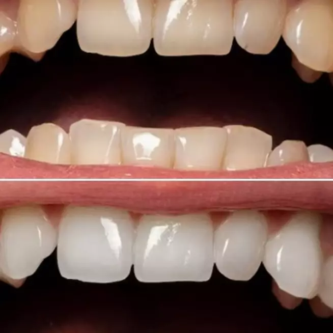 Trik memutihkan gigi kuning membandel cuma pakai 3 jenis buah, tanpa pakai garam