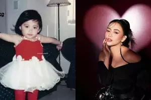 10 Transformasi Rachel Vennya dari SMP sampai sekarang, gayanya makin glowing dan bikin pangling