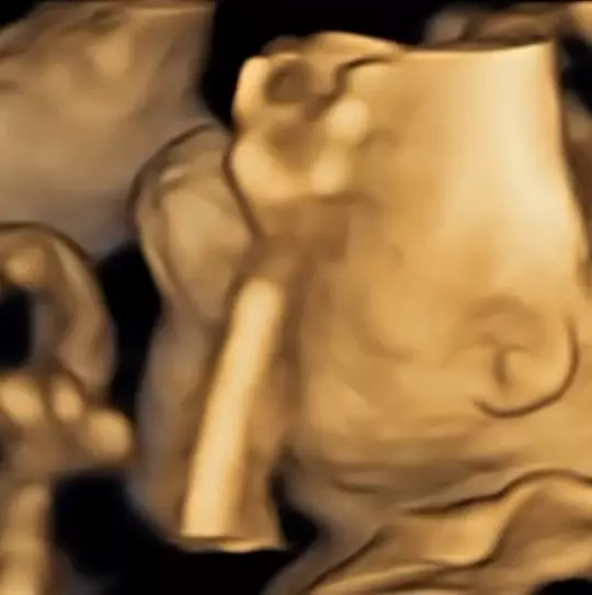 Istri Nino RAN hamil anak pertama © 2025 Instagram