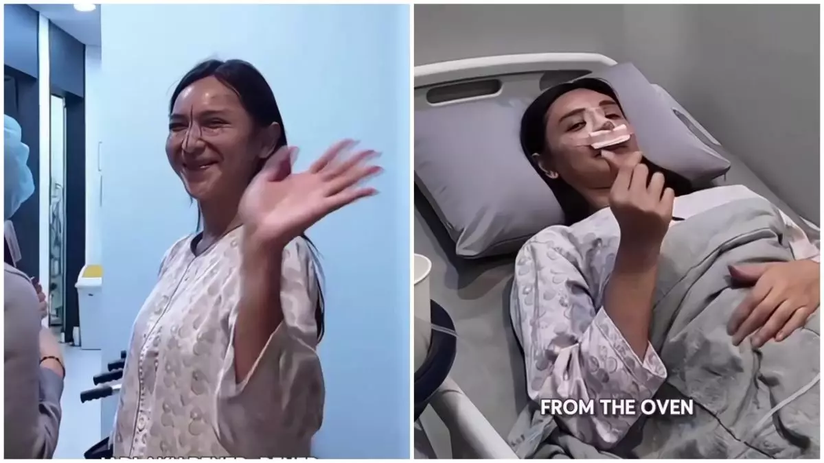 Ingin perbaiki hidung bengkok, ini 7 potret Dena Rachman jalani rhinoplasty dan fat graft