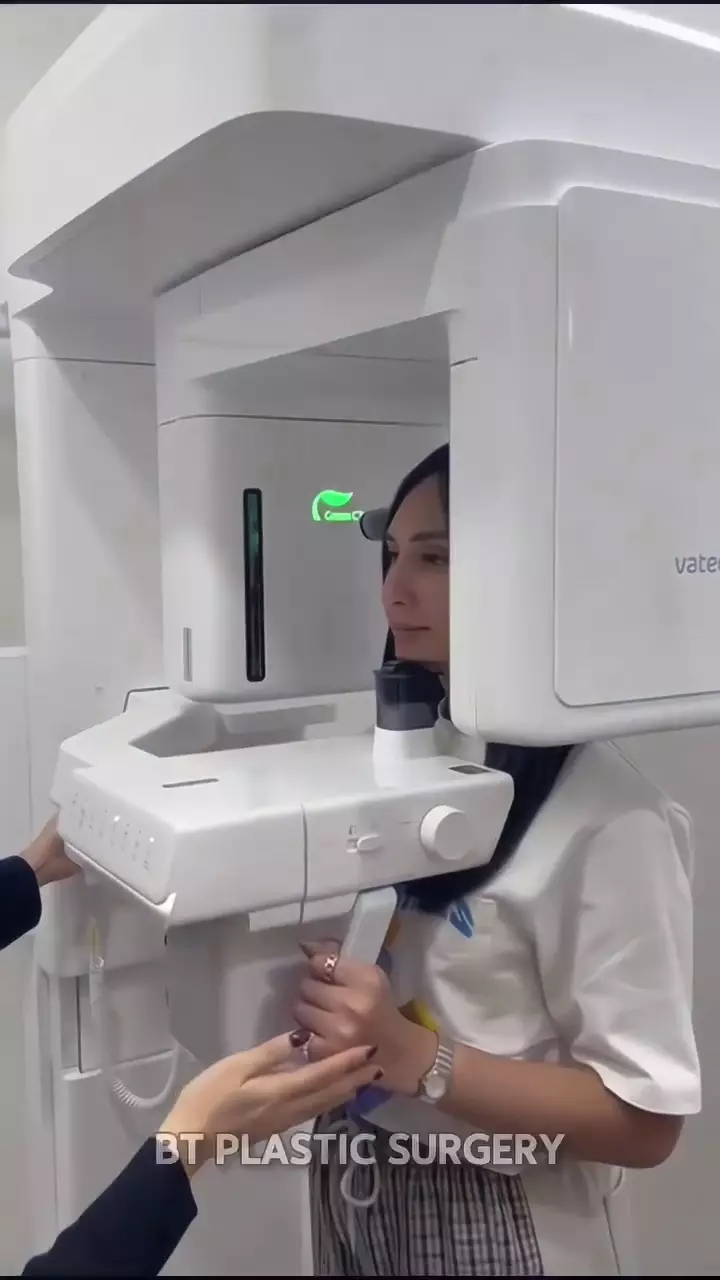 Dena Rachman jalani operasi plastik © 2025 Instagram