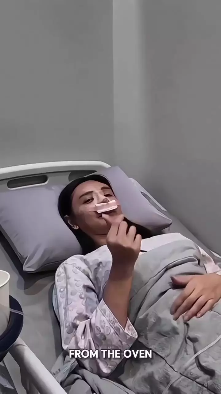Dena Rachman jalani operasi plastik © 2025 Instagram