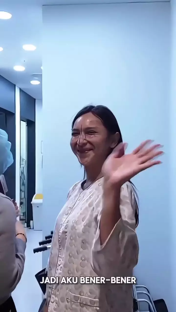 Dena Rachman jalani operasi plastik © 2025 Instagram