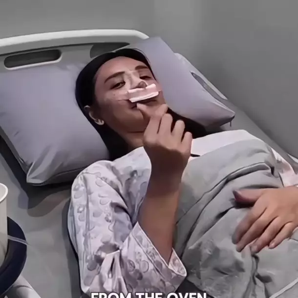 Ingin perbaiki hidung bengkok, ini 7 potret Dena Rachman jalani rhinoplasty dan fat graft